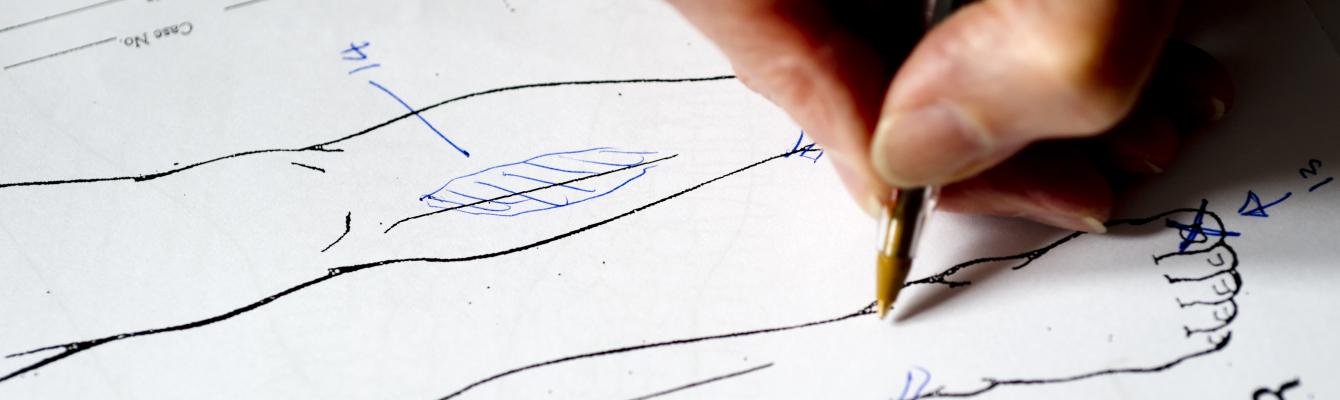 A medico-legal report diagram documenting scars from torture on a person's leg