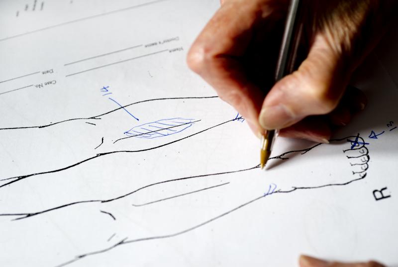 A medico-legal report diagram documenting scars from torture on a person's leg