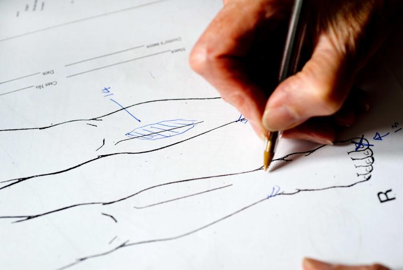 A medico-legal report diagram documenting scars from torture on a person's leg
