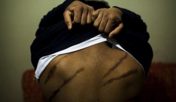 Sri Lankan Torture Survivor