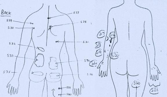 Medico-Legal Report