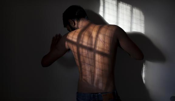 Sri Lanka back scars